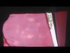 UPSKIRT 343